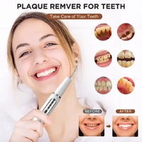 White Portable Ultrasonic Dental Cleaner, Home Use Plaque Remover, Sonic Tooth Stain & Tartar Cleaning Tool thumbnail