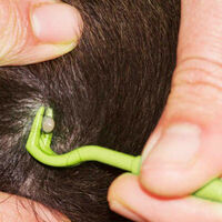 Mitey Tick Free Tick Remover Kit thumbnail
